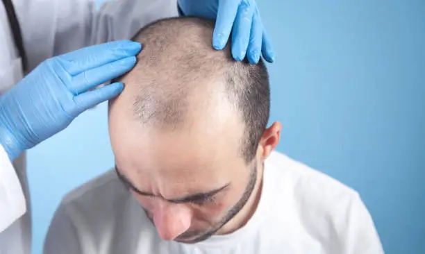 rejoice hair-transplant